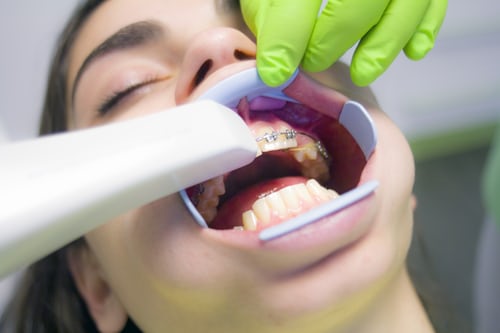The main reasons you need to visit a professional dentist today!